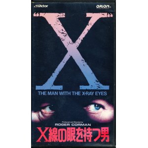 画像: Ｘ線の眼を持つ男