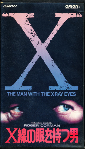 画像1: Ｘ線の眼を持つ男